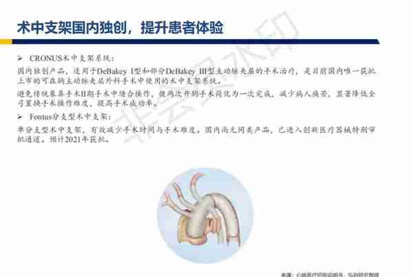 心脉医疗行业深度报告：主动脉与外周血管介入开疆拓土