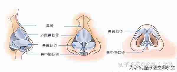 歪鼻有哪几种类型，又该如何修复？